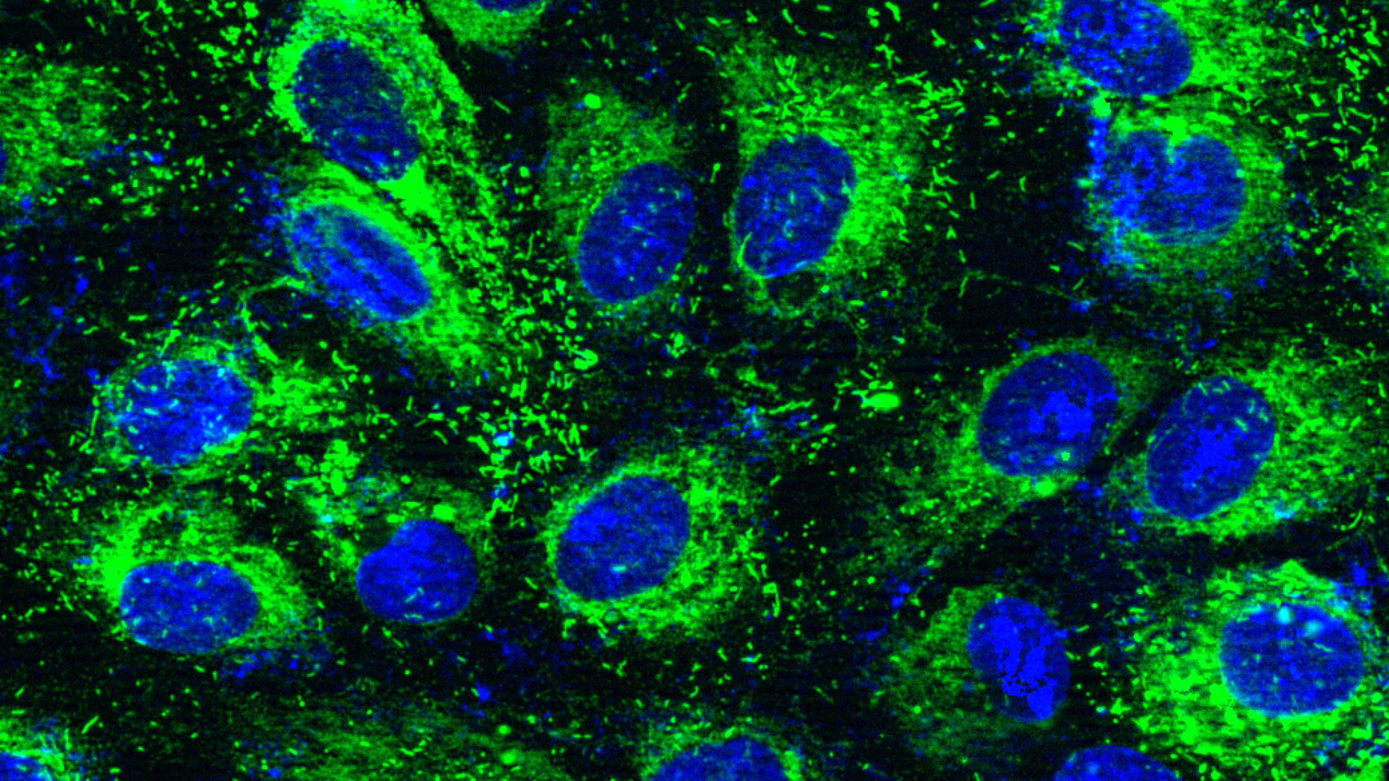 Endothelial Colony Forming Cells MELERO MARTIN LABORATORY